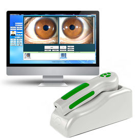 12 MP High Resolution USB de Digitale Iridology Analysator van de het Lichaamsgezondheid van Oogiriscope